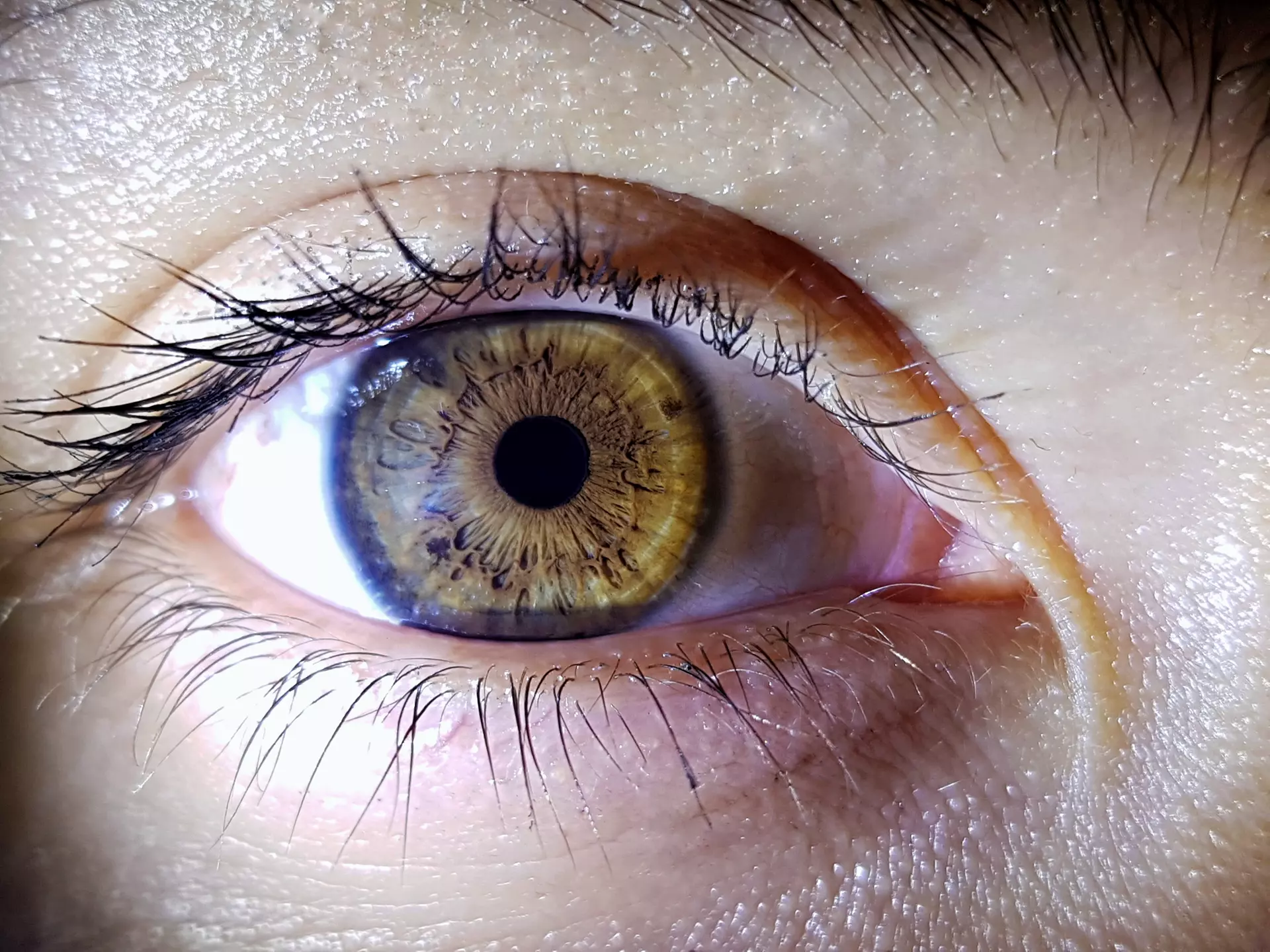 Optomap Retinal Map